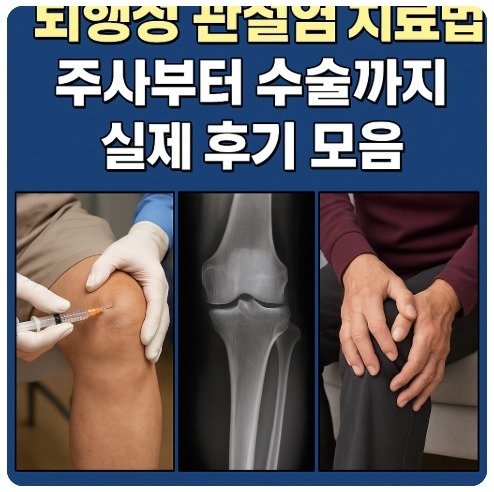 퇴행성 관절염 치료법